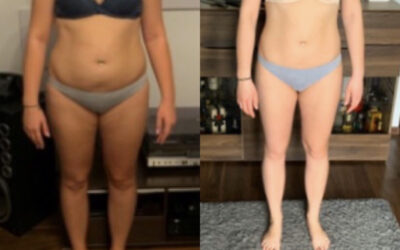 ANETA -10KG